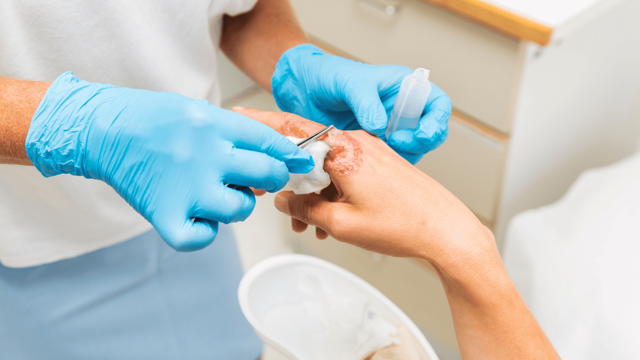 wound Infection Management